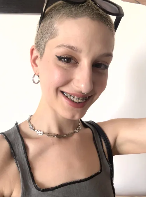 Thumbnail Fetish for Braces: Exploring a Unique Kink | Author sexypotionn | Fetish Category