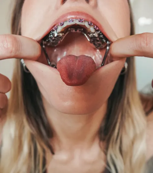 Thumbnail Exploring the Metal Fetish: A Personal Journey by andie_x | Fetish Discussion