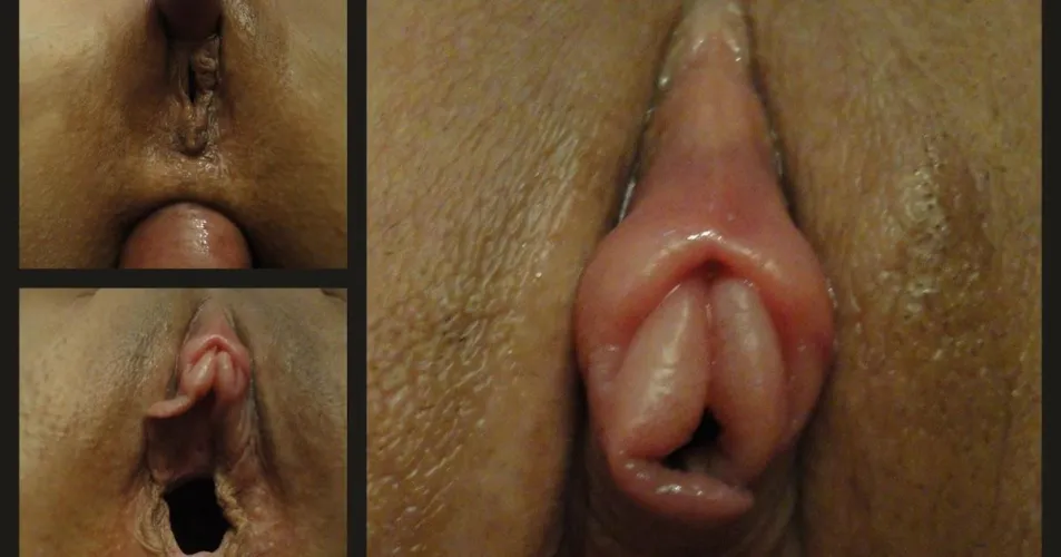 Thumbnail Pumped Clit of My Wife's by No-Dot-6954 | Intimate Revelations