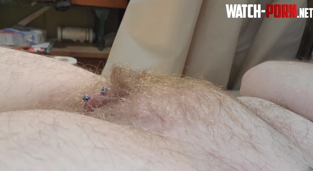 are hairy ginger mounds your thing by ftm666incubus