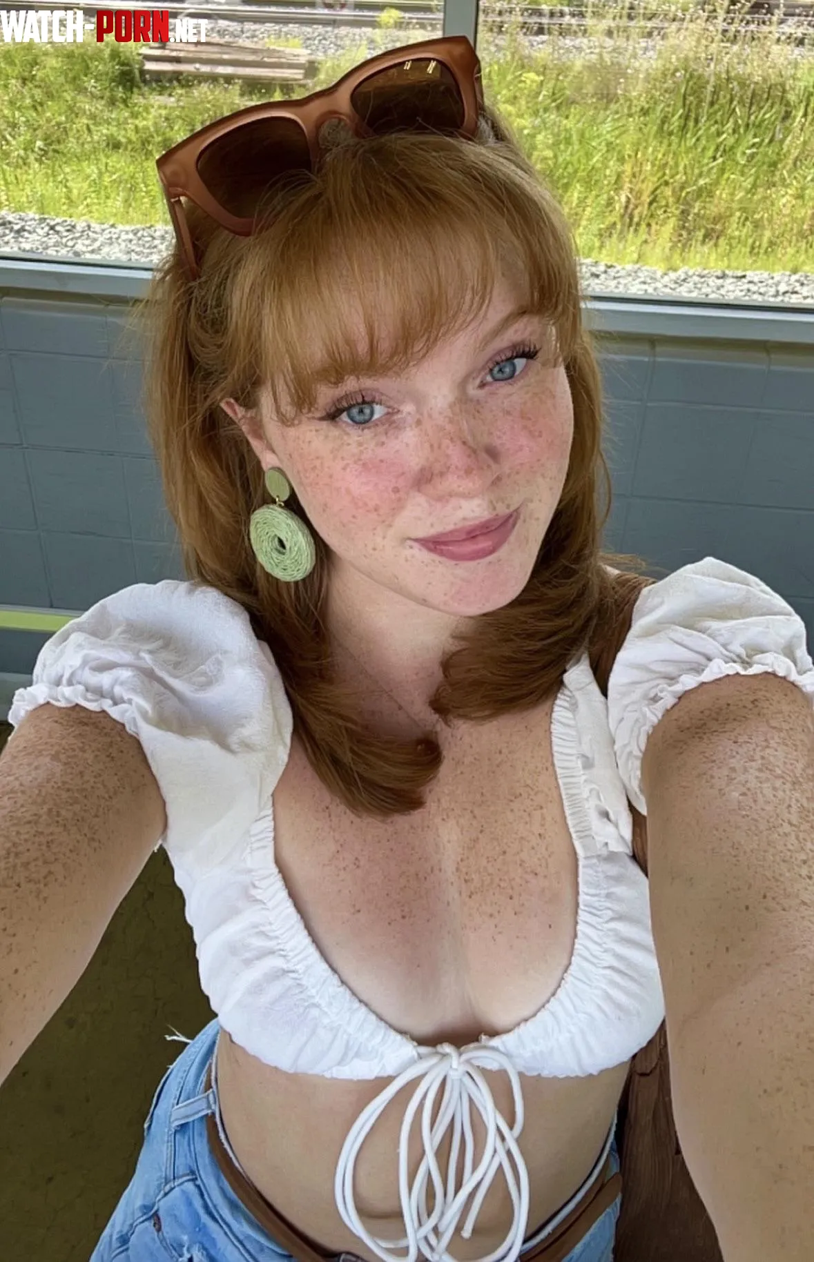 summer freckles by awfully-loud16