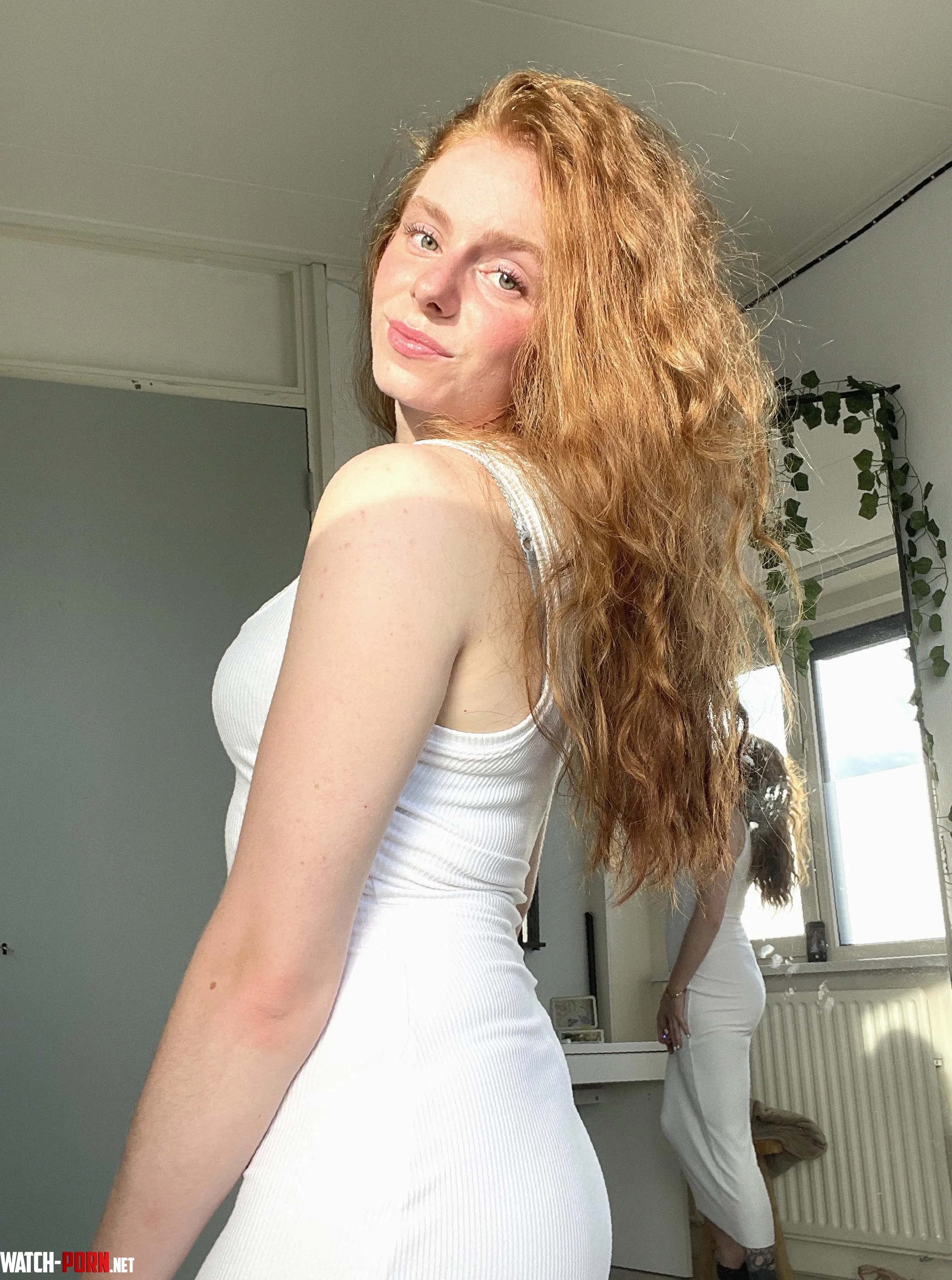 Are freckles the best summer lookn by Beautiful_Dish_5881