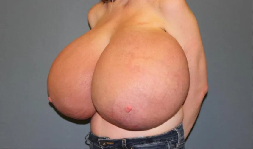 Thumbnail Balloon Journey: Six Cup Sizes in a Week