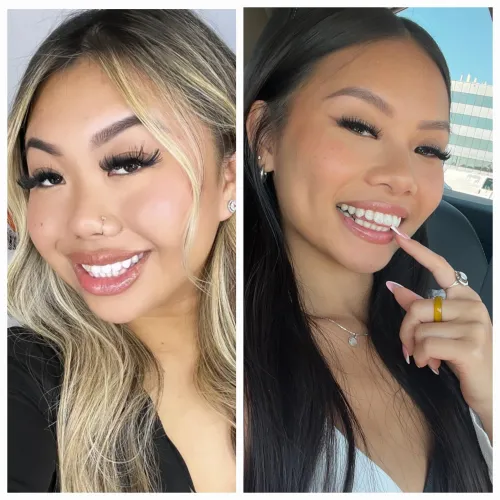 Thumbnail PuzzleheadedTiger975 Asks: Left or Right?