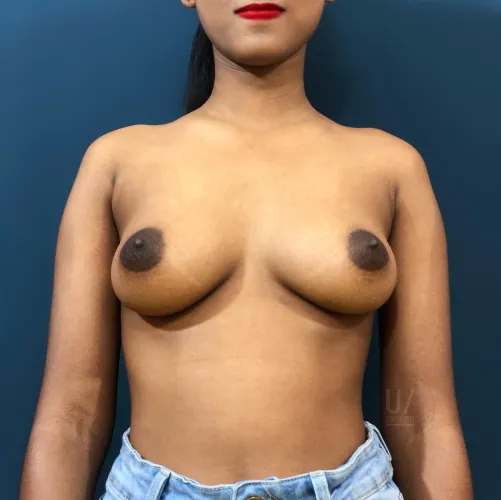 Thumbnail Confidence and Feedback: Crimspie's Reflection in ratemyboobs