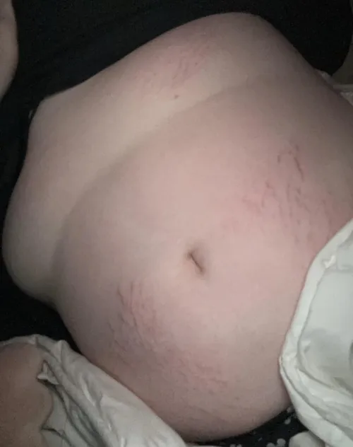 Thumbnail Never Escaping the Stretch Marks - st0nedcut1e | Stuffers Category