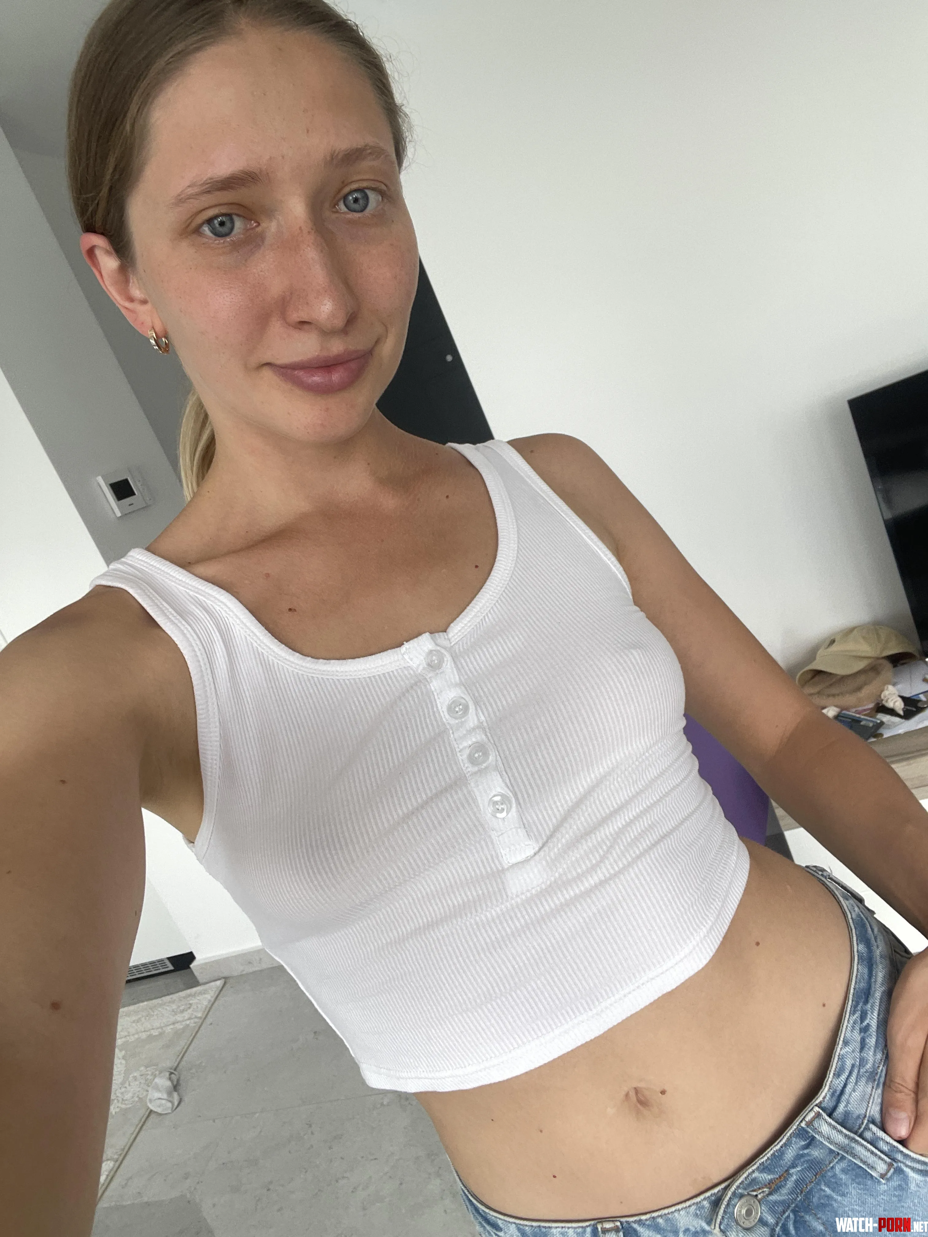 I enjoy having my freckles on this amazing day by Kkeysi