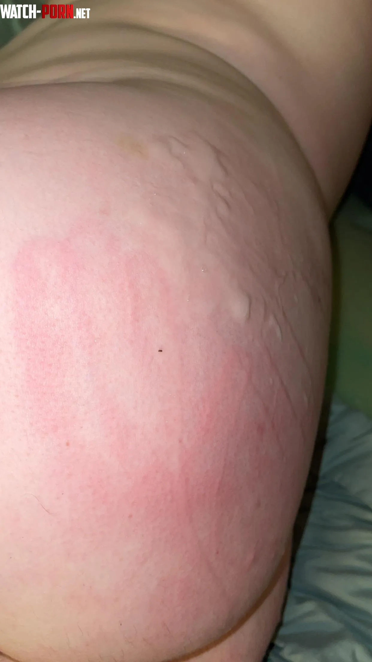 All over my freshly spanked ass  by Krae337