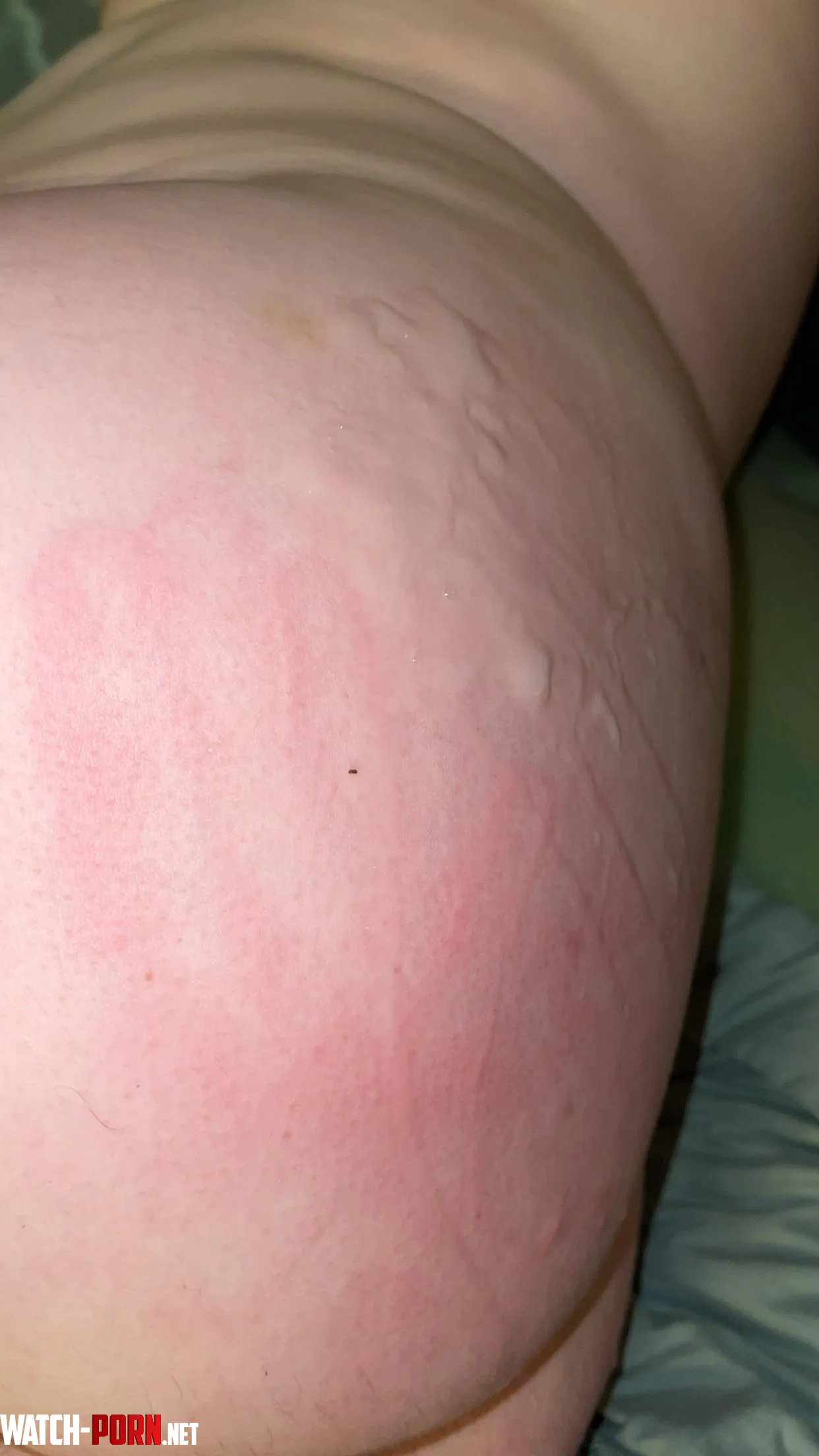Dripping down my freshly spanked ass  by Krae337