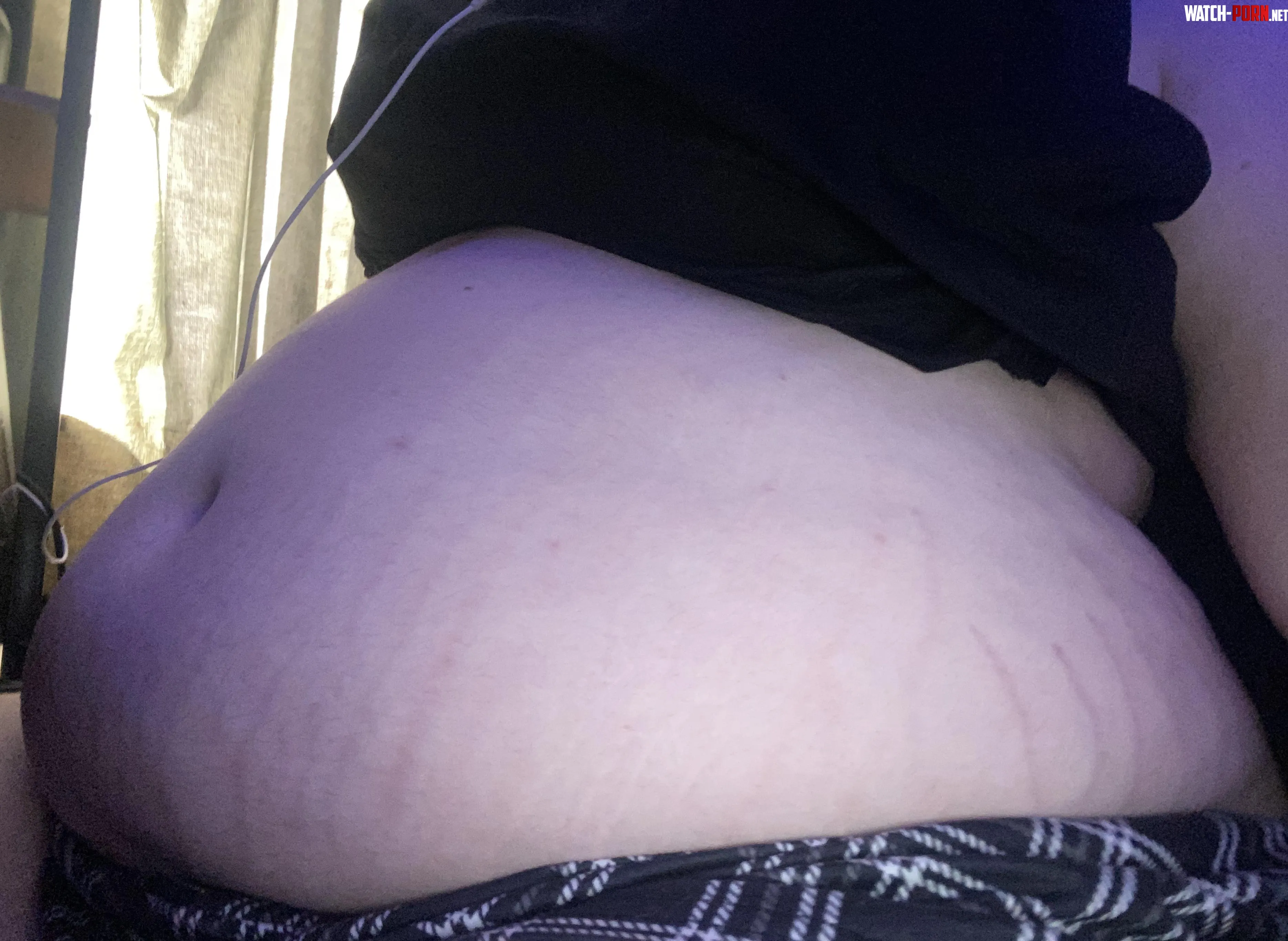 my stretch marks have been fading i want them back  by fatWG