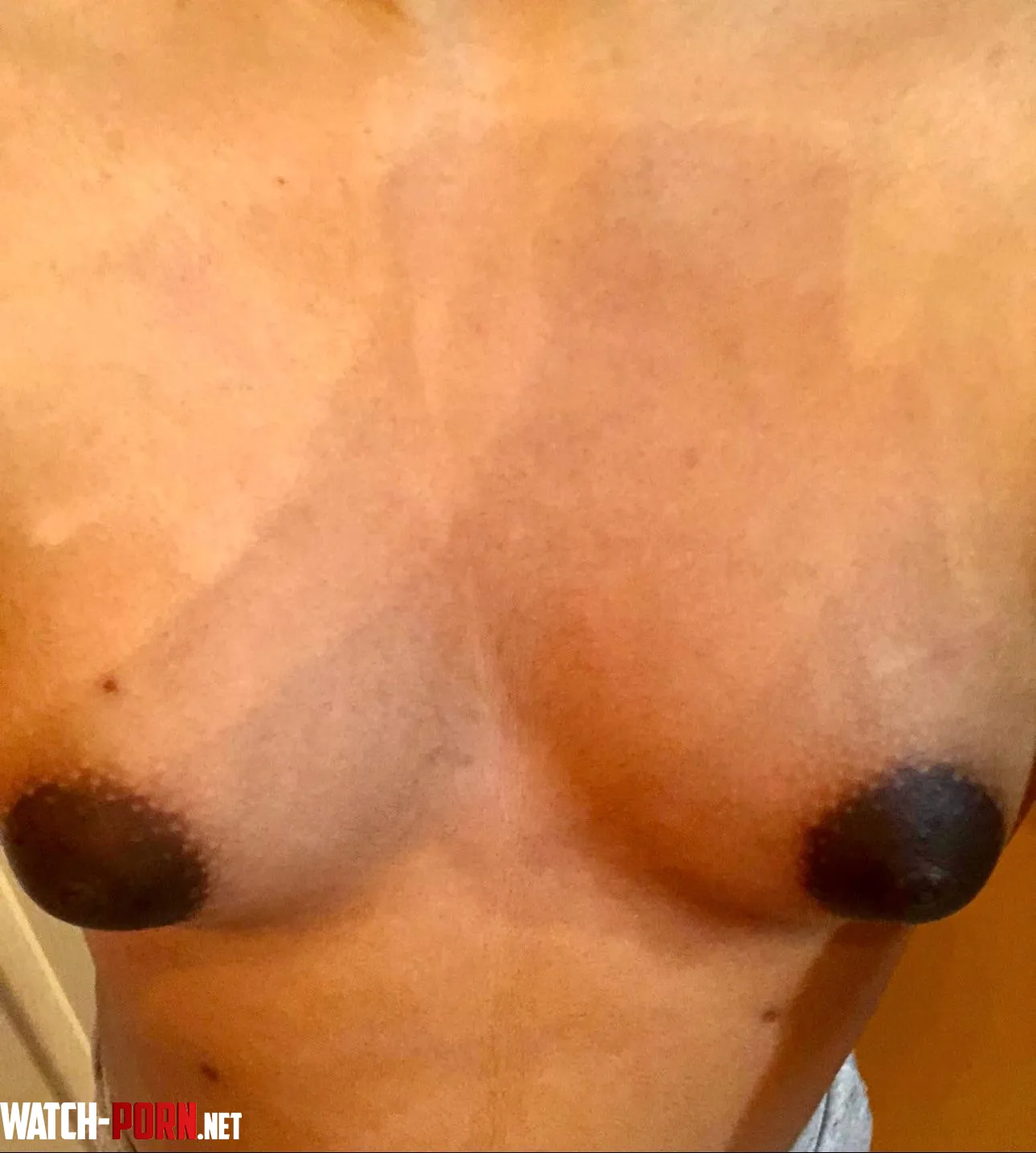 I took hormones for 3 months and quit Is there a way to get my A cup breasts back to normal ever  by Background-Program48