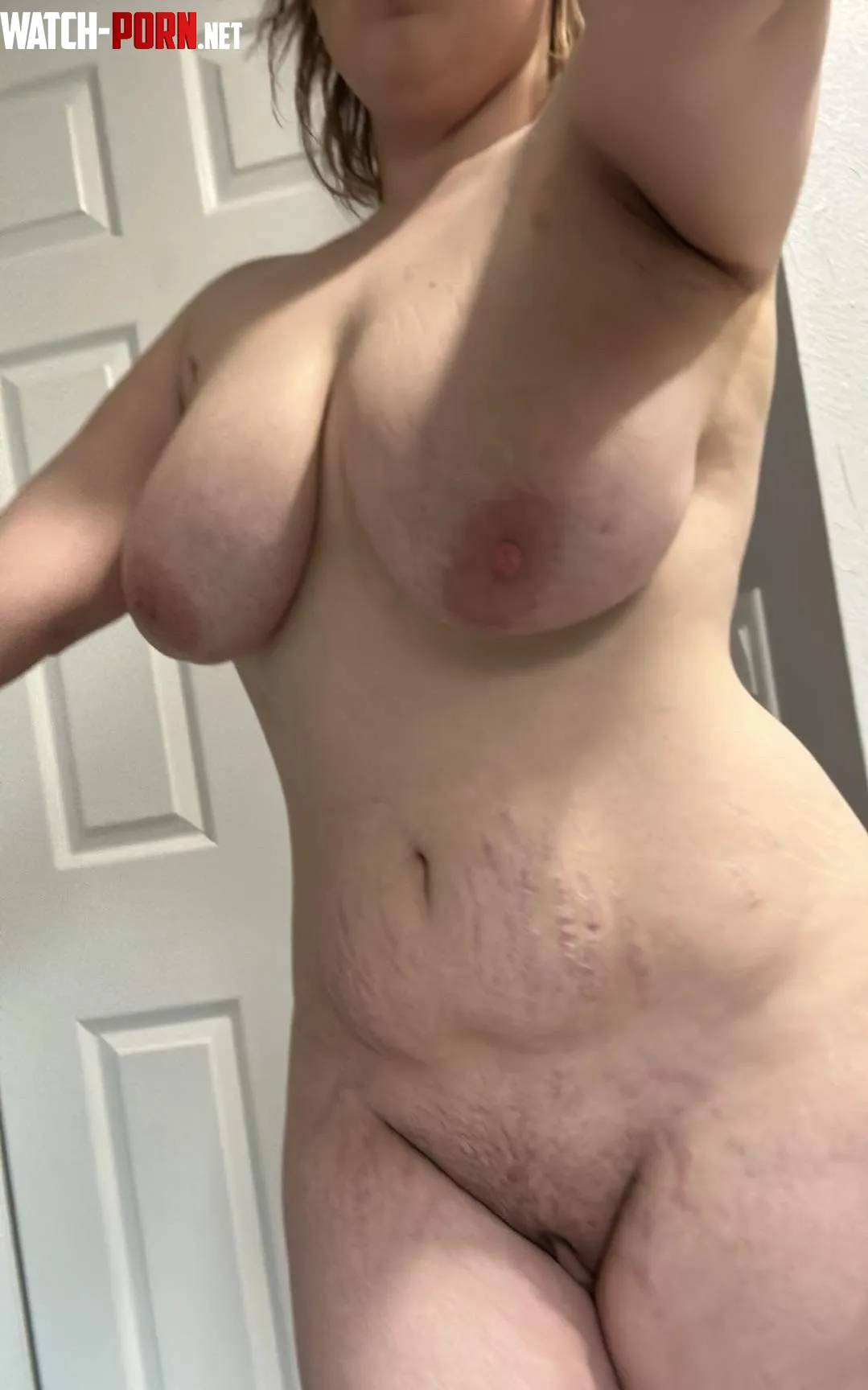 Do you mind stretch marks  by QueenC0razon