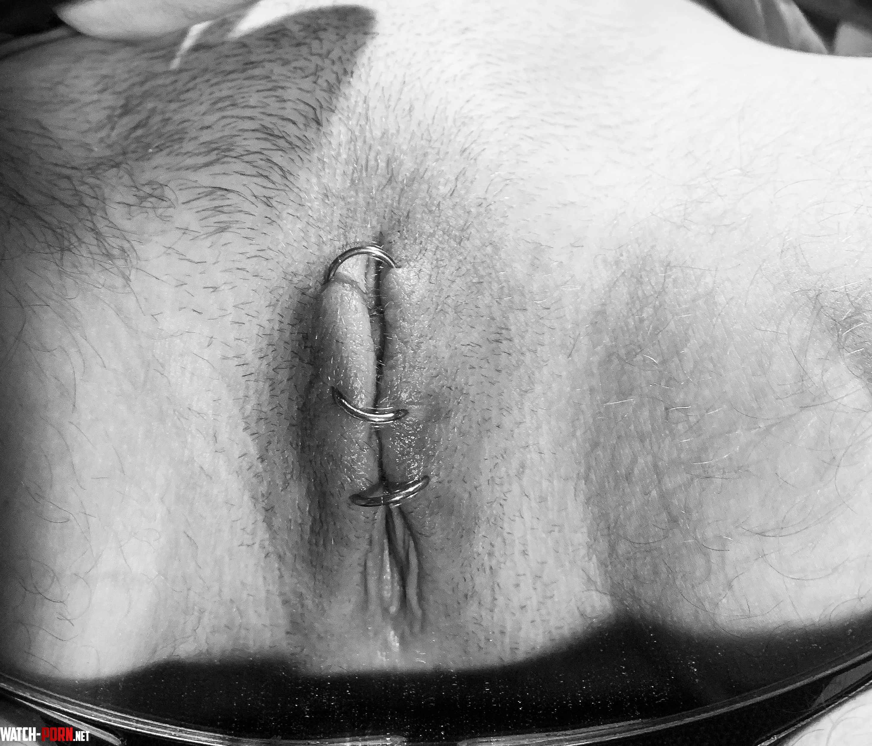 nicely stitched up no access to clit at all ftm by ompsytecy