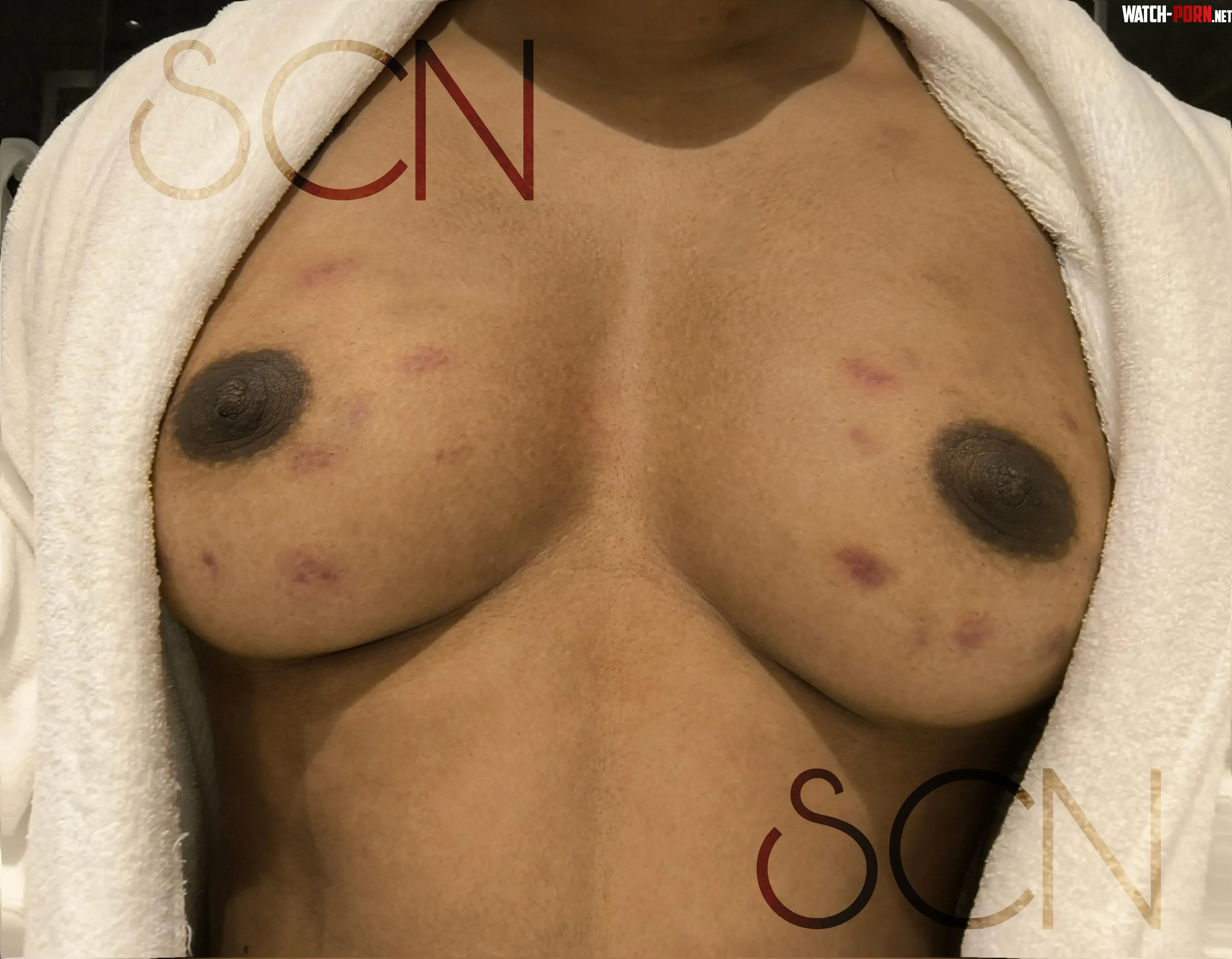I said I hated my boobs and he did this by scardycatnearyou