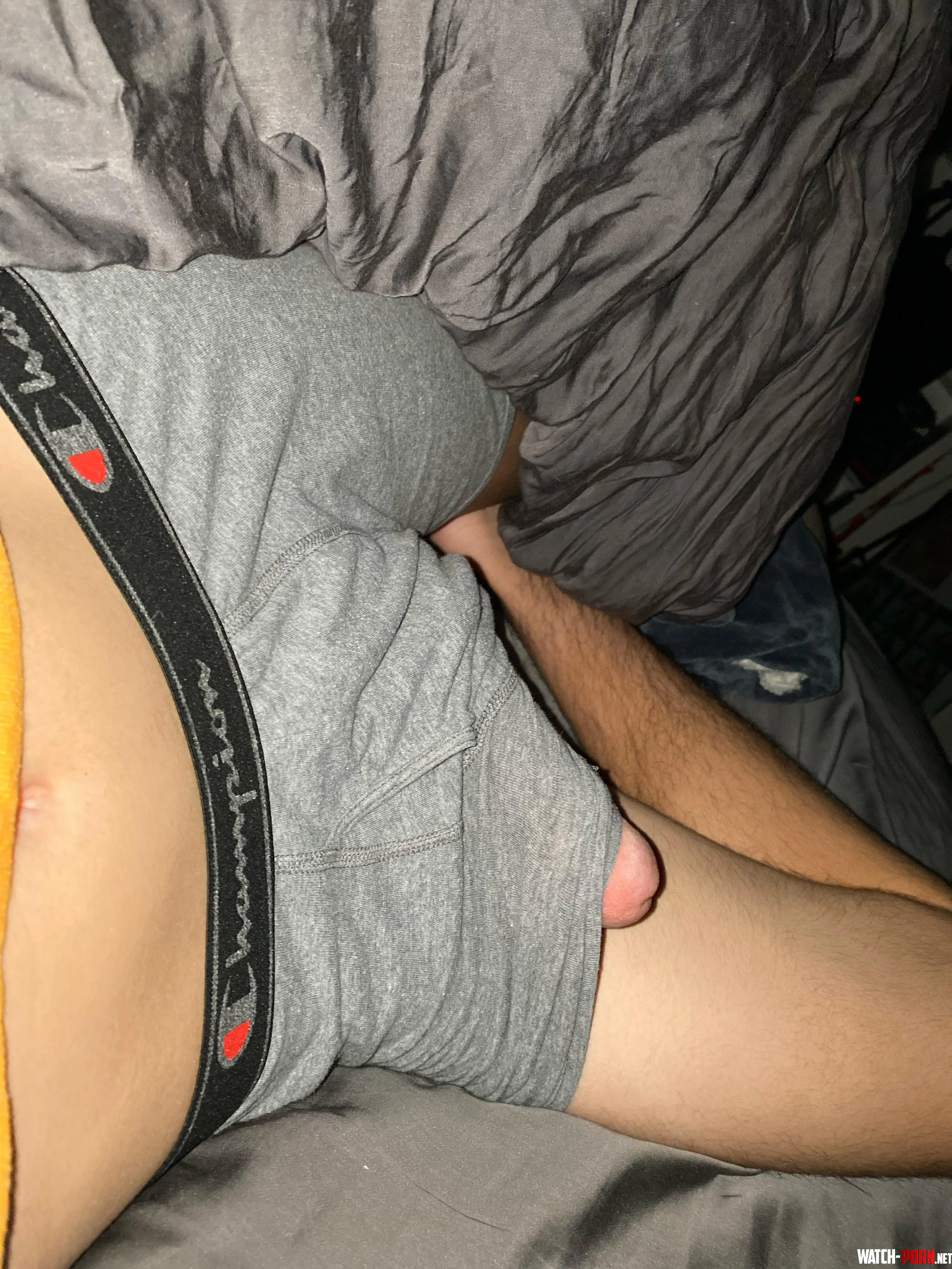 bulging out by Hopeful_Jello9579