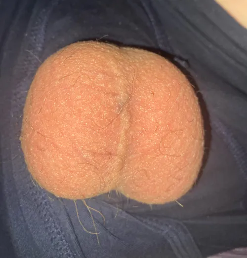 Thumbnail  18Nutsack by Dependent-Humor4178