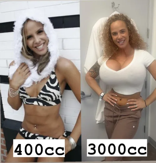 Thumbnail Loving Plastic Surgery: A BimboFetish Perspective
