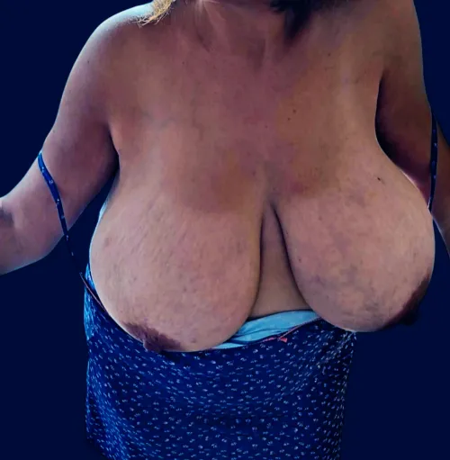 Thumbnail Captivating Beauty: Embracing Veiny and Heavy Breasts