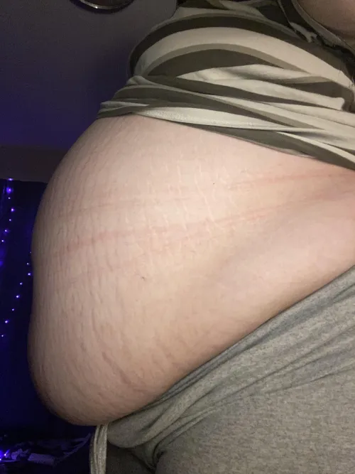 Thumbnail Stretch Marks and Piggy Growth - Feedmeadelina's Journey