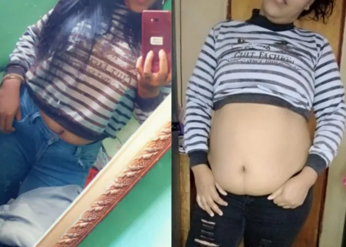 Thumbnail Sexy Body Evolution: chikiandrys93's WGBeforeAfter Revelations