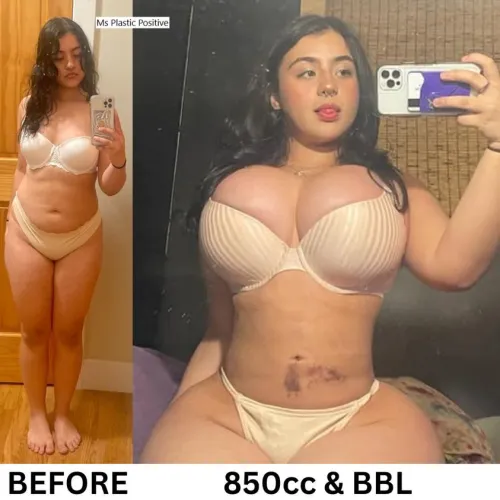 Thumbnail Embracing Bigger Dreams at 18: Bimbo Fetish Tales | sofiasummers