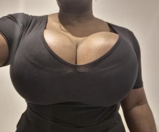 Thumbnail UK's Biggest Boobs: Post-Op Glow Up by PoisonThorneX | boltedontits