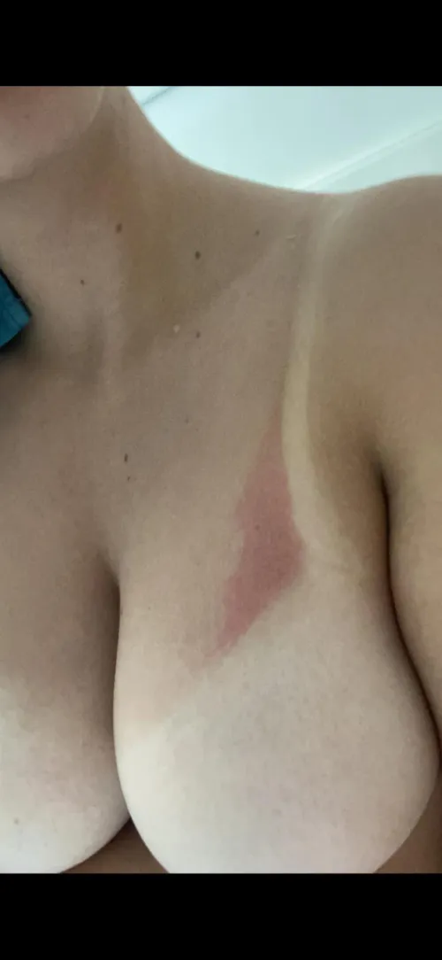 Thumbnail Sun-Kissed Confessions: Fantighost Regrets Lack of Sunscreen