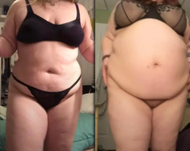 Thumbnail Starphucker: Incredible Before and After Transformations of Huge Weight Gain