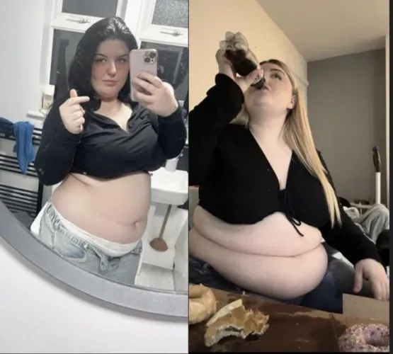 Thumbnail KingBaldwinofBalogna's Tale: Poor Girl Turned Junk Food Addict | wgbeforeafter