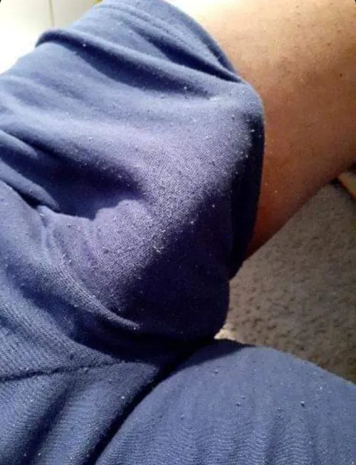 Thumbnail Versatile Identity - MasterpieceNo6020's Self-Expression | Bulges