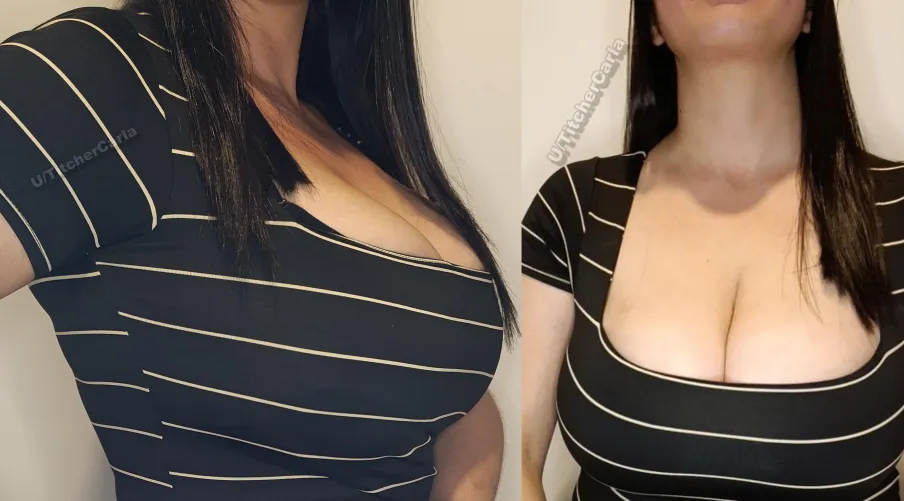 Thumbnail Front or Side View: Massive Tits Unveiled by TitcherCarla