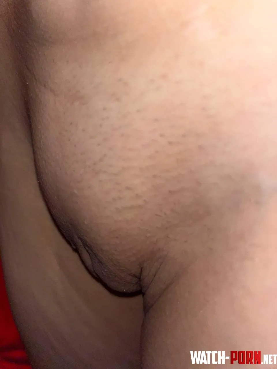 its not cyst just pure petite by latinadoit
