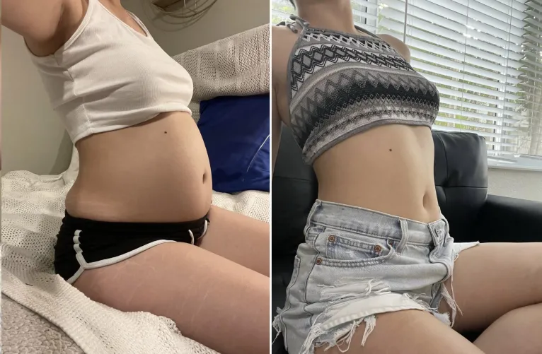 Thumbnail Transformative Journey: Weight Gain Shakes and Fullness in wgbeforeafter