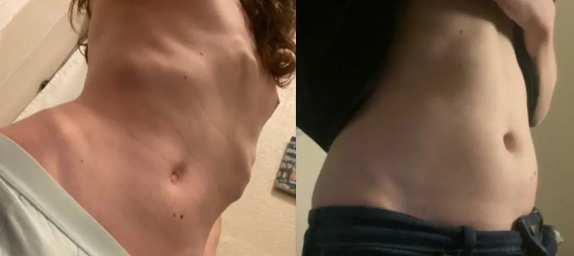 Thumbnail Eating 5k Cals a Day: Impact on My Summer Body Transformation | Worldly-Respect2668