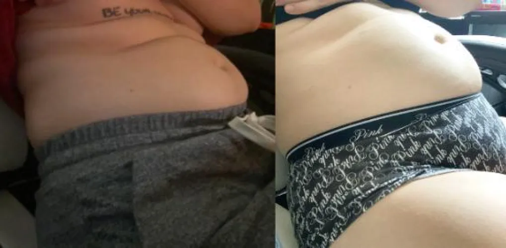 Thumbnail Progress: Under a Month, 6lbs Gained | BellyyBeanzz | wgbeforeafter