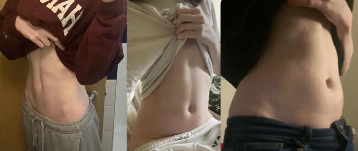 Thumbnail My First Month of Gaining Weight: A Comprehensive Timeline by Worldly-Respect2668