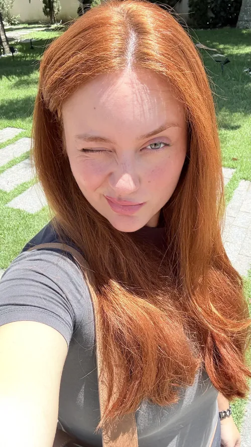 Thumbnail Puzzled_MJ's Sunny Narrative: Freckles under the Sun