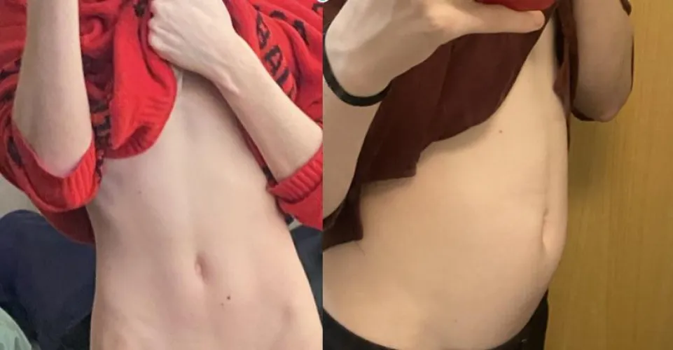 Thumbnail Seeking Fun and Laughter: Wgbeforeafter Adventures Shared