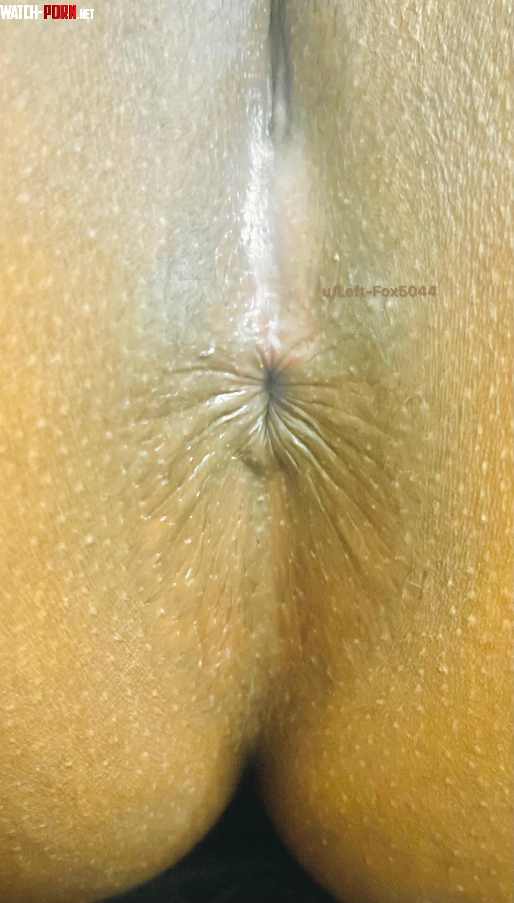 My indian asshole close up what would you do first by Left-Fox5044