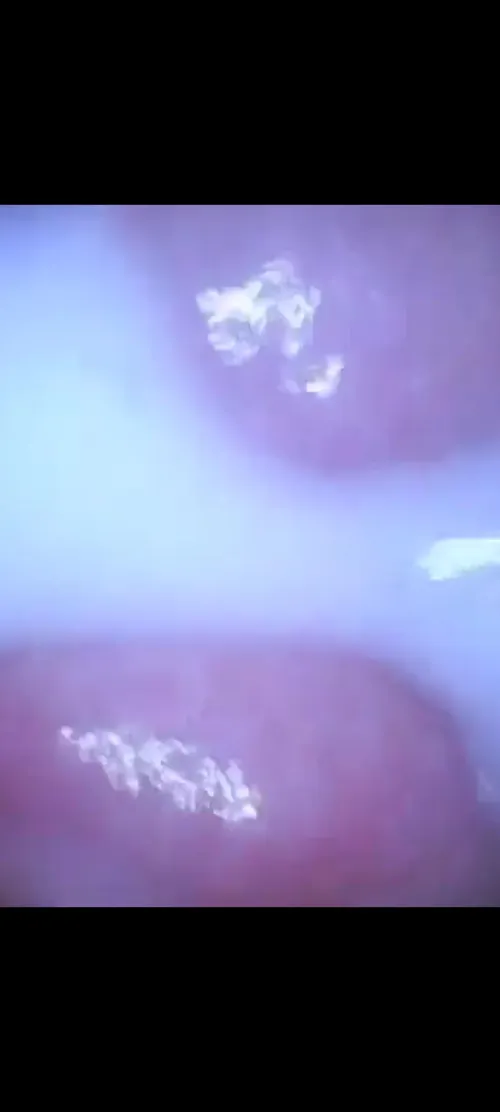 Thumbnail baldcock65's Explicit Shot: Internal View Unveiled
