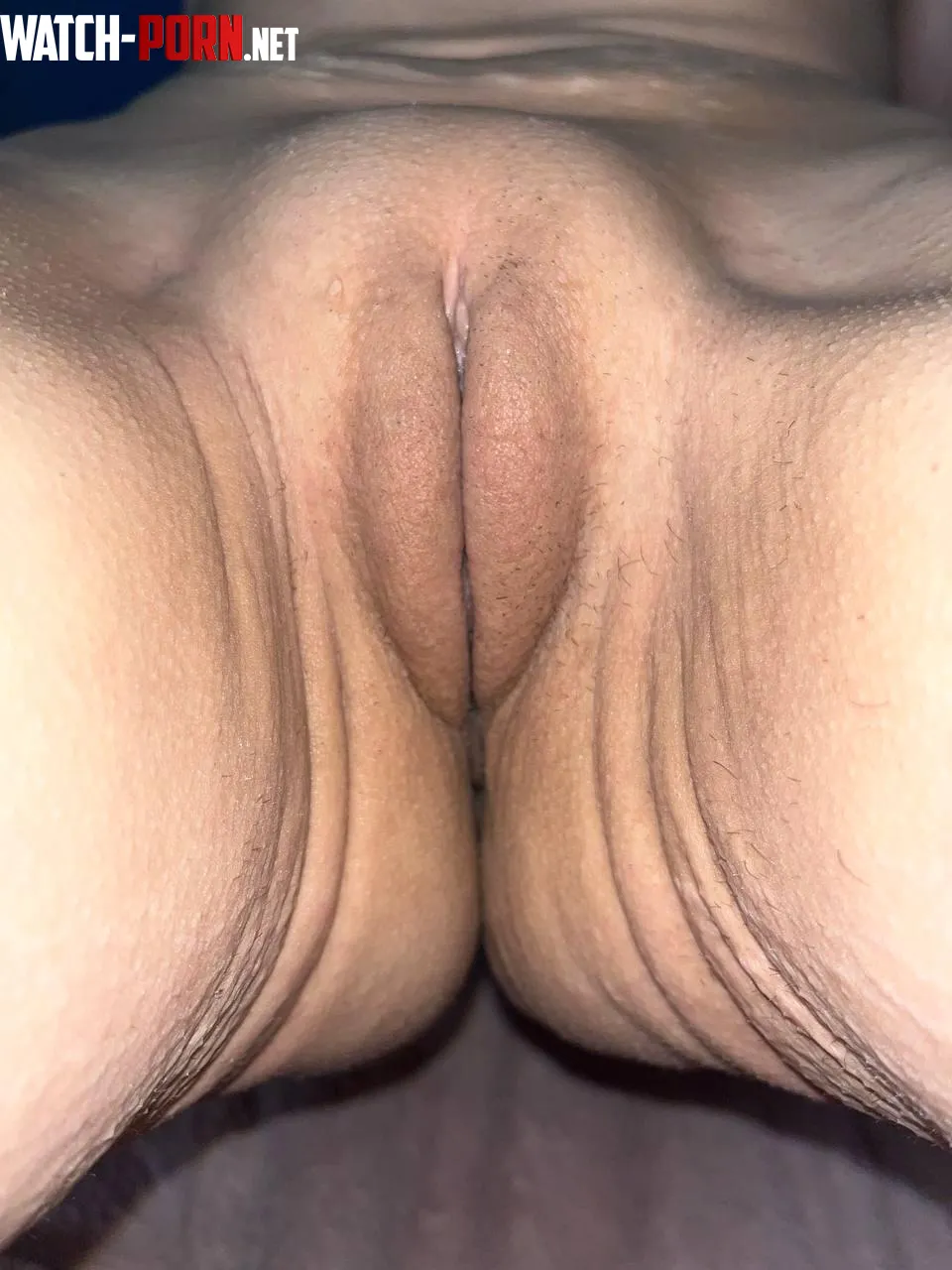 innie with saggy stripes just the way you like it by latinadoit