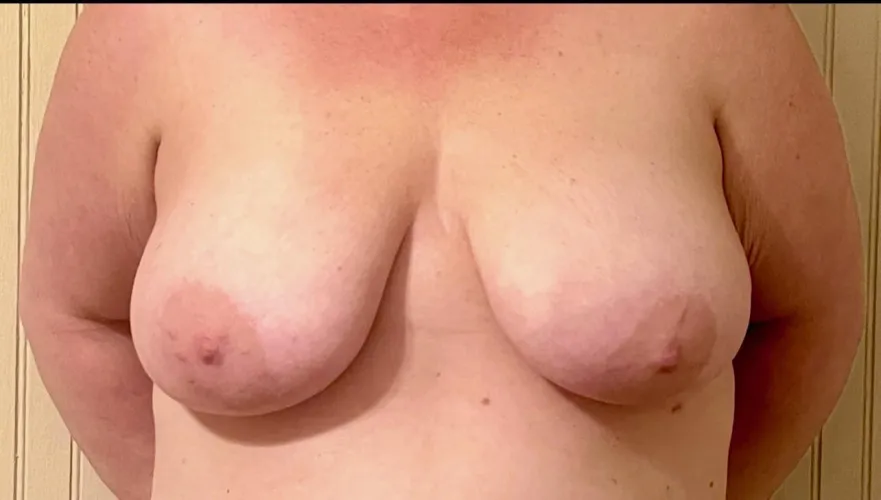 Thumbnail F40 Boob Review: Your Opinion Needed on RateMyBoobs