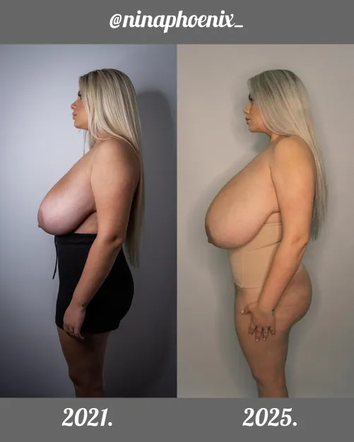 Thumbnail Body Positivity Journey: The Rest of My Body is Almost the Same by ninaphoenix_
