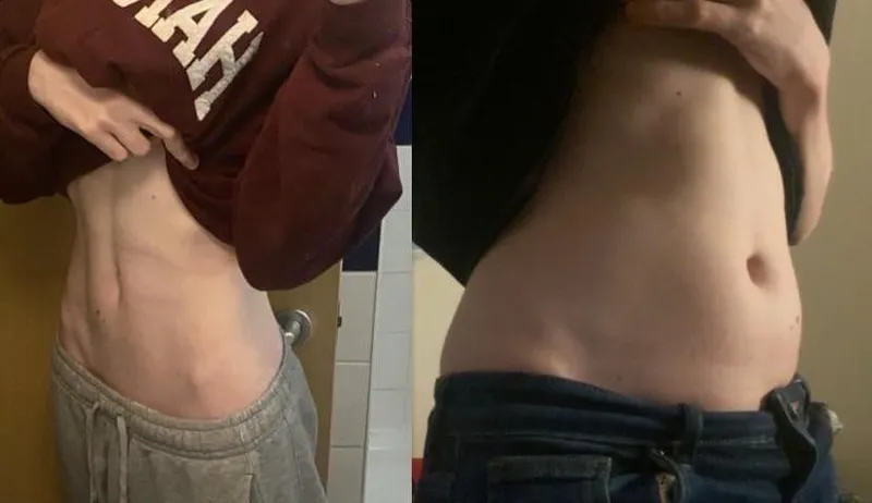 Thumbnail Achieving Weight Gain Goals: A WGBeforeAfter Journey by LongjumpingEcho7748