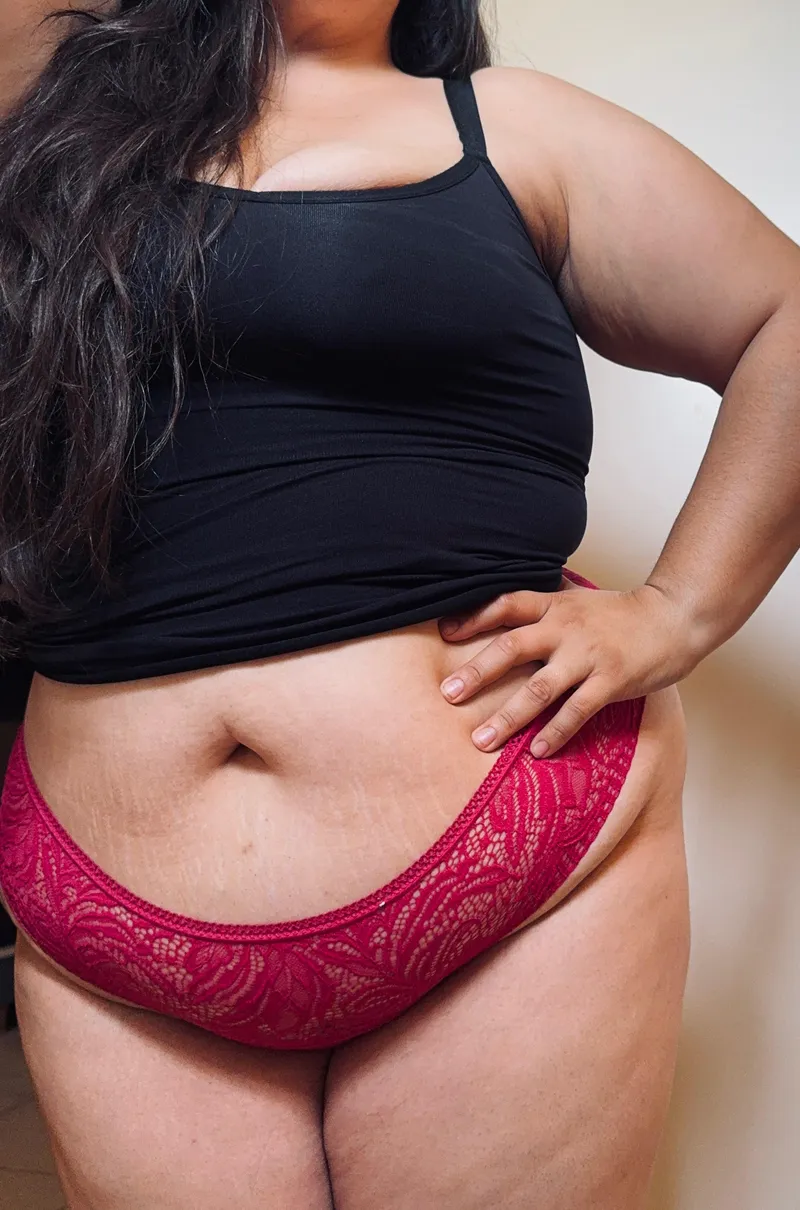 Thumbnail Embracing Imperfections: Learning to Love Stretch Marks by Jpy149