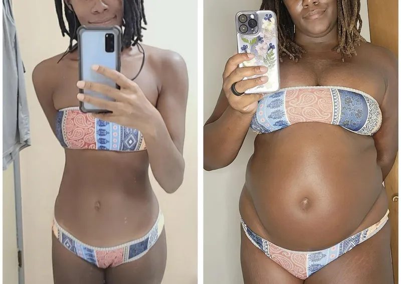 Thumbnail Summer-Ready Body Transformation Unveiled! - pitten- | wgbeforeafter