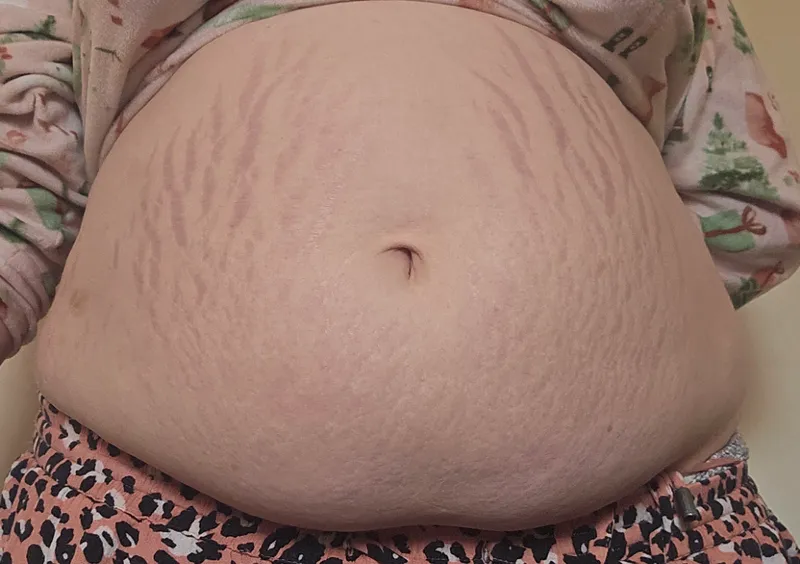 Thumbnail Join the Stuffers Journey: In the UK 20 Years Old and 280 Pounds