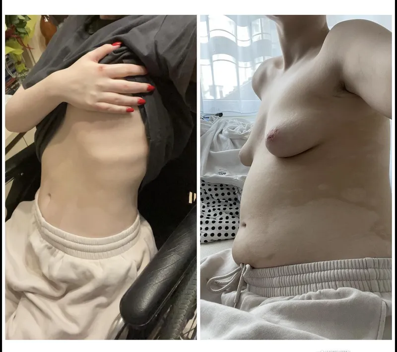 Thumbnail Soft Transformation: Soggy_Horse_9922's WGBeforeAfter Journey