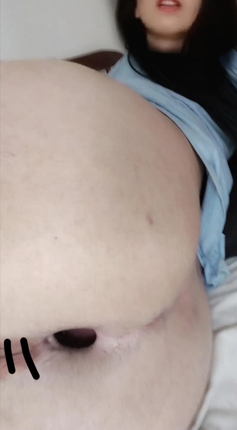 Thumbnail soldaderyan's Unusual Kink: Permanent Open Butthole & Closed Pussy at 29 in gape Category