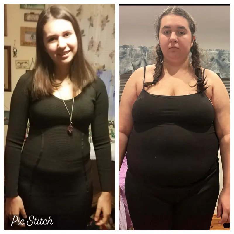 Thumbnail ZaraGainer's Transformation: From Fit to Morbidly Obese